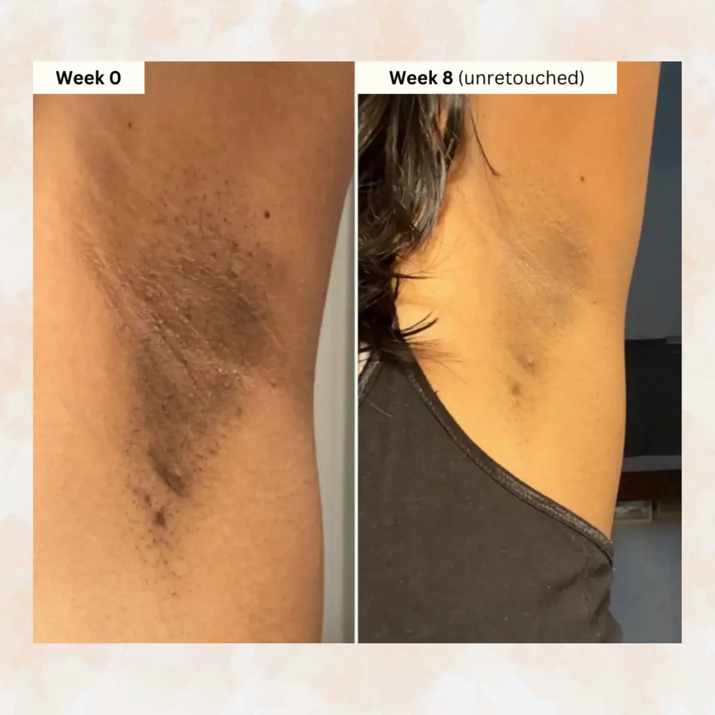 🔥🎁 2025 HOT Deal 💥Lovilds Orange Exfoliating Gel🔥Limited Time 50% OFF🔥