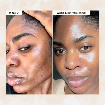 🔥🎁 2025 HOT Deal 💥Lovilds Orange Exfoliating Gel🔥Limited Time 50% OFF🔥