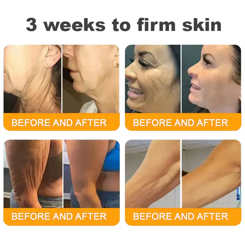 ✨FDA Approved:LOVILDS™  Bee Skin Restoration Cream — 🔥Limited Time 70% OFF🔥