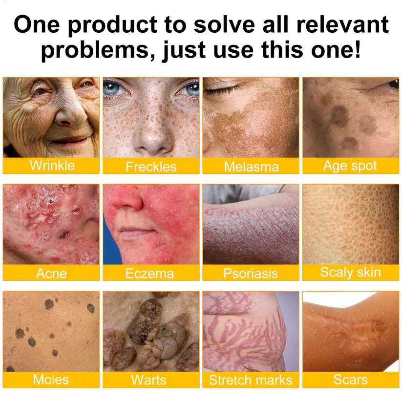 ✨FDA Approved:LOVILDS™  Bee Skin Restoration Cream — 🔥Limited Time 70% OFF🔥