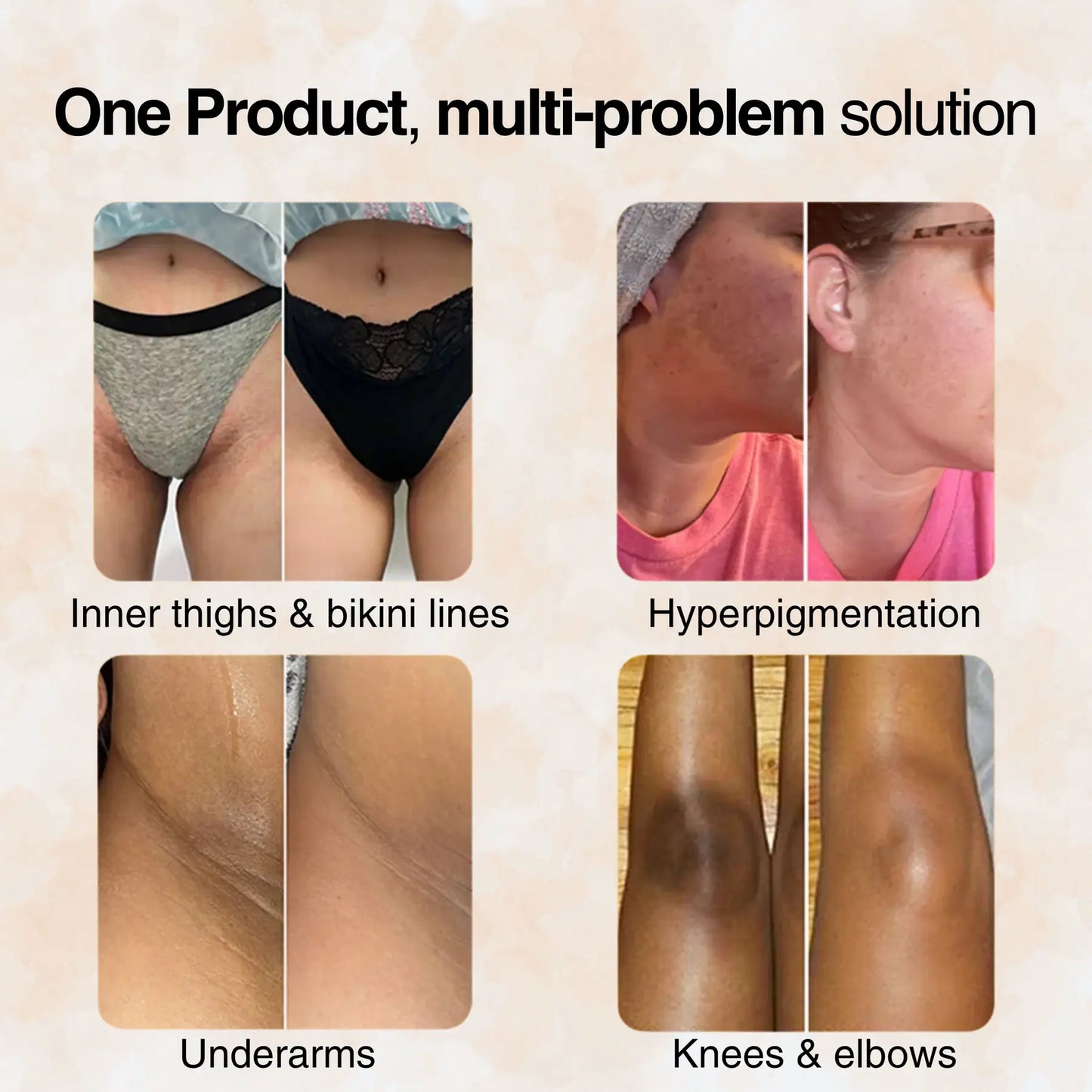 🔥🎁 2025 HOT Deal 💥Lovilds Orange Exfoliating Gel🔥Limited Time 50% OFF🔥