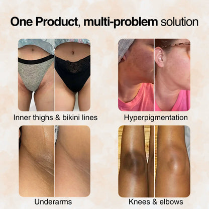 🔥🎁 2025 HOT Deal 💥Lovilds Orange Exfoliating Gel🔥Limited Time 50% OFF🔥